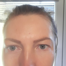 Kde v Praze na operaci horních víček