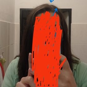 Odstávající vlasy