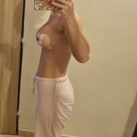 Pocit obrovskych prsou po augmentaci