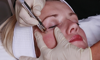 Diamantová abraze 1