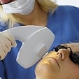 IPL (intenzivní pulzní světlo) 3