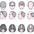 Alopecie 5