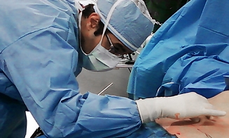 Ultrazvuková liposukce 1