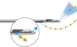Water+jet liposukce (WAL) 1
