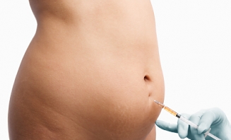 Injekční lipolýza 1
