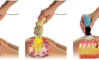 Neinvazivní mezoterapie 1