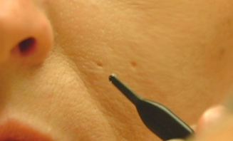 Rozšířené póry 1